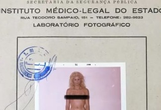"MONSTRO, PROSTITUTA E BICHINHA" conheça a humilhante história da primeira cirurgia de mudança de sexo feita no Brasil